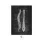 Canvas Painting Of Human Anatomy Skeleton Organ System